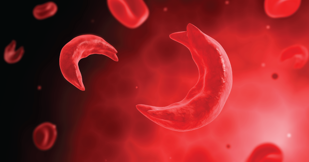 World Sickle Cell Day