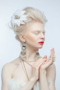 International Albinism Awareness Day